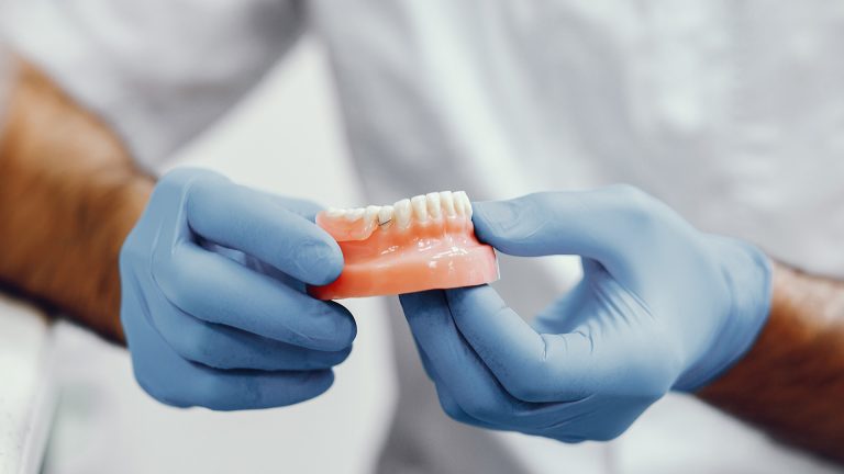 Tandarts met handschoenen houdt tandheelkundige brug vast – Tandheelkundig Centrum Nederland