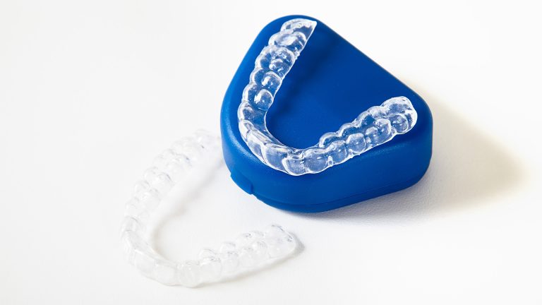 Doorzichtige beugel in blauw bewaardoosje