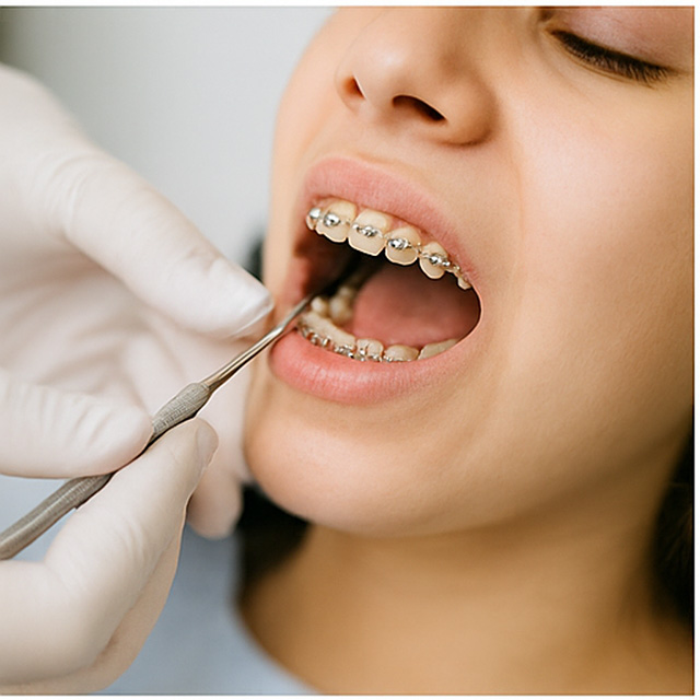 Orthodontist onderzoekt het gebit van een meisje